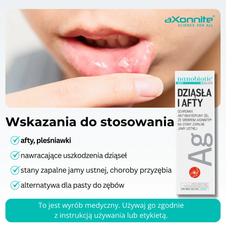 Dziąsła i Afty (2).png